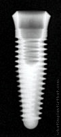 Radiograph of Internal Taper (Tapered)