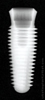 Radiograph of Internal Taper (Tapered)