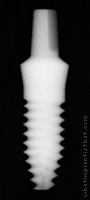 Radiograph of Immediate Stabilization (ISI)