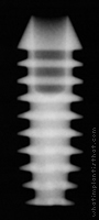 Radiograph of Integra-CP (2.0mm Well)