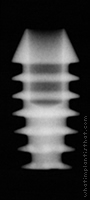 Radiograph of Integra-CP (2.0mm Well)