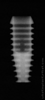 Radiograph of Integra-CP (2.0mm Well)