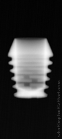 Radiograph of Integra-CP (2.5mm Well)