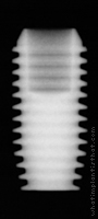 Radiograph of Integra-CP (3.0mm Well)