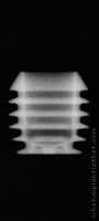 Radiograph of Integra-CP (3.0mm Well)