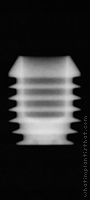 Radiograph of Integra-CP (3.0mm Well)