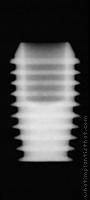 Radiograph of Integra-CP (3.0mm Well)