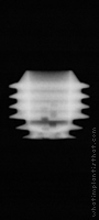 Radiograph of Integra-CP (3.0mm Well)