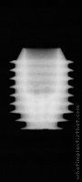 Radiograph of Integra-CP (3.0mm Well)