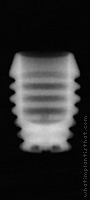 Radiograph of Integra-CP (3.0mm Well)