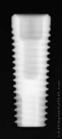 Radiograph of Internal Hex