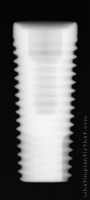 Radiograph of Internal Hex