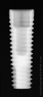 Radiograph of Internal Hex