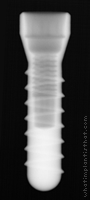 Radiograph of Internal Taper (Narrow Platform)