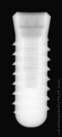 Radiograph of Internal Taper (Regular Platform)