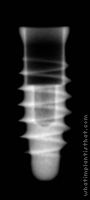 Radiograph of Exacone Max Stability