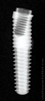 Radiograph of External Hex Co-Axis MSc (Tapered)