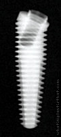 Radiograph of External Hex Co-Axis MSc (Tapered)