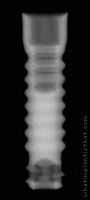 Radiograph of Micro-Vent