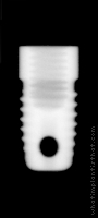 Radiograph of Steri-Oss Flat Top