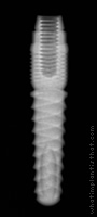 Radiograph of Naturex
