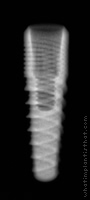 Radiograph of Naturall+