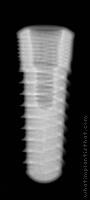 Radiograph of Naturall+