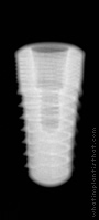 Radiograph of Naturall+