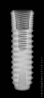 Radiograph of Natea+