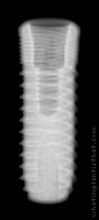Radiograph of Natea+
