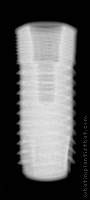 Radiograph of Natea+