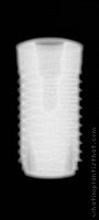 Radiograph of Natea+