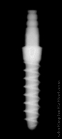Radiograph of Nano 2