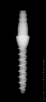 Radiograph of Nano 2