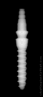 Radiograph of Nano 3