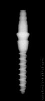 Radiograph of Nano 3
