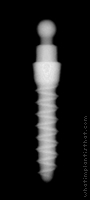 Radiograph of Nano OVD