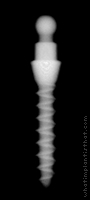 Radiograph of Nano OVD