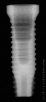 Radiograph of NanoTite Certain PREVAIL