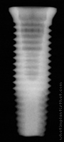 Radiograph of NanoTite Certain PREVAIL
