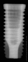 Radiograph of NanoTite Certain PREVAIL
