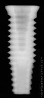 Radiograph of NanoTite Certain PREVAIL