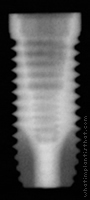 Radiograph of NanoTite Parallel Walled Certain