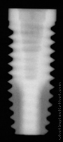 Radiograph of NanoTite Parallel Walled Certain