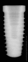 Radiograph of NanoTite Tapered Certain PREVAIL