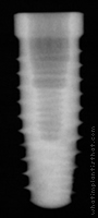 Radiograph of NanoTite Tapered Certain PREVAIL