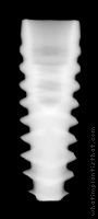 Radiograph of NobelActive Internal RP