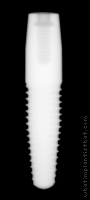 Radiograph of NobelDirect Groovy RP