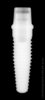 Radiograph of NobelDirect Posterior RP