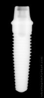 Radiograph of NobelDirect Posterior WP